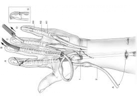 Tendon spacer